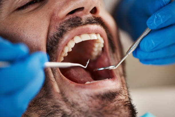 Best Broken Tooth Emergency  in Gang Mills, NY